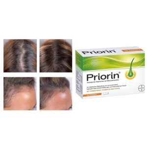 قرص پریورین intense بایر آلمان ١٢٠ عددی